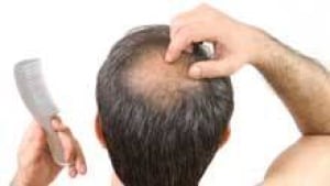 si-220-bald