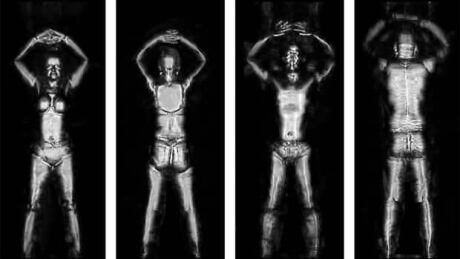li-nb-body-scan-image