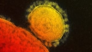 si-coronavirus-220-cp-04405