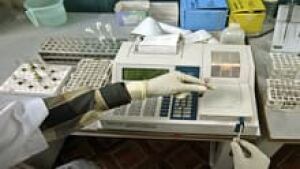 si-hepatitis-blood-test-220