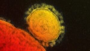 si-mers-coronavirus-220-cp-