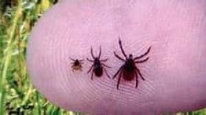 tp-mb-tick-lyme-306-cbc