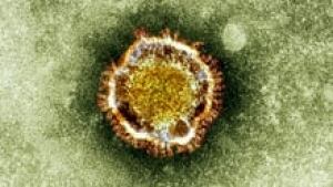 si-coronavirus-220-cp-03984