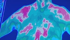 mi-thermography