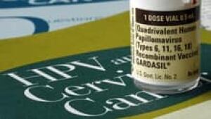 si-hpv-220-cp-6337352
