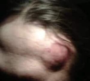 cgy-crowchild-2headbump