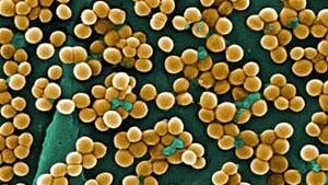 mi-mrsa