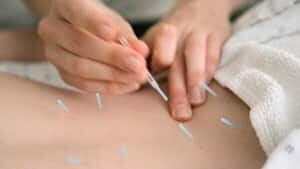 hi-wdr-acupuncture-ap-file-4col