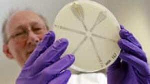 si-klebsiella-ndm-bacteria-