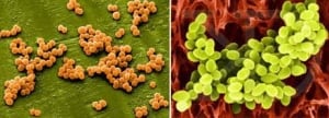 staphylococcus-aureus