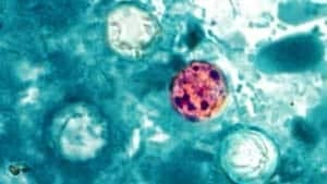 si-cyclospora-04798737
