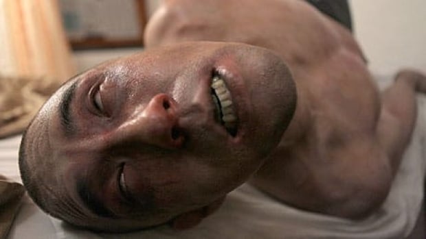 li-afflicted_01_tiff