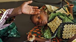 mi-malaria-malnutrition-cp-