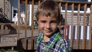 Kayleb Dulaurier was attacked by a bull mastiff in the yard of his Northgate area home Tuesday. His