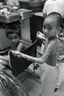 Kim Phuc, age 9