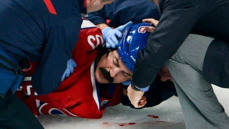 nhl news Drop the Gloves: Parros injury puts spotlight on NHL fights