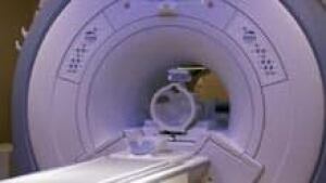 si-mri-stock-220