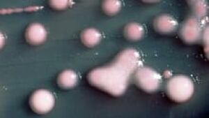 si-bacteria-klebsiella-ndm-