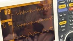 si-heart-monitor-220-cp-rtr