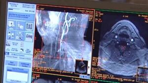 MS vein therapy
