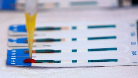 Online HIV tests to be expanded in B.C.