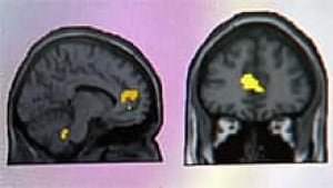 si-mri-city-stress120622