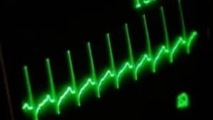 tp-heart-monitor