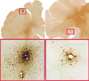 18yo_brain_scan