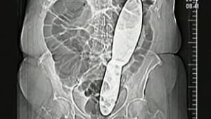 tp-czech-xray-cbc-306-100216