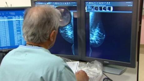 wdr-banner-mammography-doc