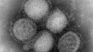 090509-swine-flu