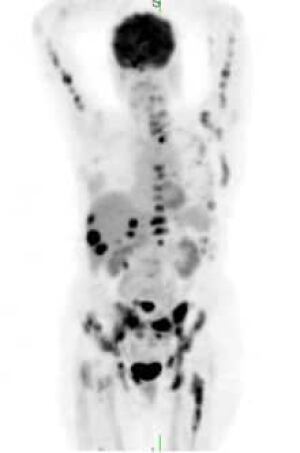 petscan-2