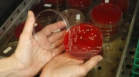 mrsa-cp-RTR1XRWD