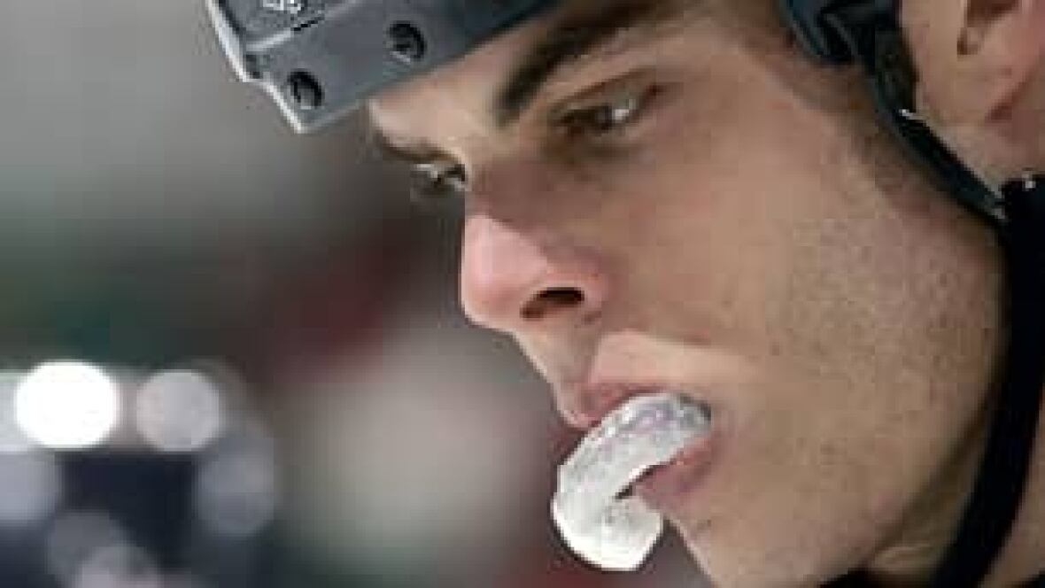 Concussions and the mouth guard myth Hockey CBC