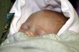 baby_cp_5203475