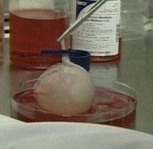 bladder_grown060403