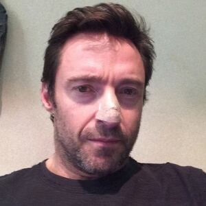 Hugh Jackman