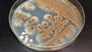 Aspergillis fungus