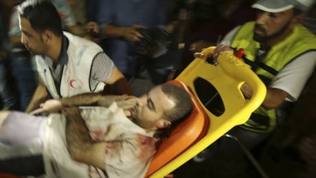 A wounded Palestinian, who hospital officials said was injured in an Israeli airstrike, is wheeled into a hospital in Gaza City July 12, 2014. An Israeli air strike on the home of Gaza's police chief killed 15 Palestinians on Saturday, the Gaza health ministry said, the deadliest attack since Israel launched an offensive in the enclave five days ago. Gaza airstrikes