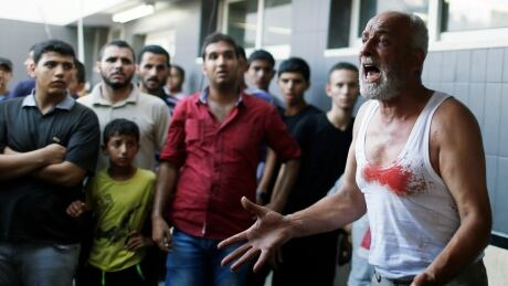 The father of a Palestinian boy reacts following his death at a hospital in Gaza City July 28, 2014. A huge explosion in a public garden in northern Gaza killed eight children and two adults, and wounded 40 others, Palestinian medics said on Monday. Locals blamed the blast on an Israeli air strike, but Israel denied responsibility, saying it was a misfire by a rocket launched by Hamas militants. MIDEAST-GAZA/HOSPITAL
