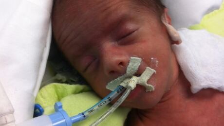 Baby Ayden breathes using a ventilator on Jan. 27, after being born prematurely at 31-weeks on Jan. 8 in Villahermosa, Mexico.
Baby Ayden