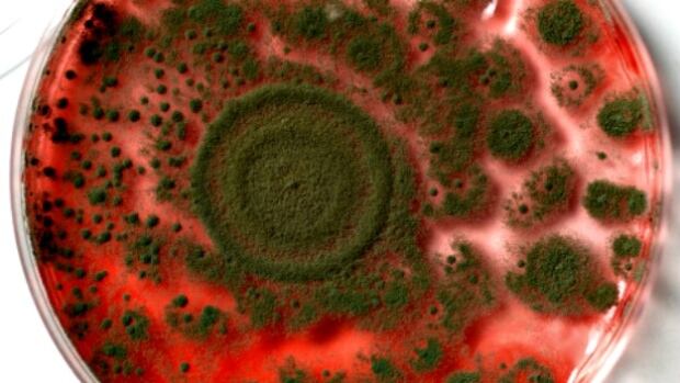 Bacteria in a petri dish