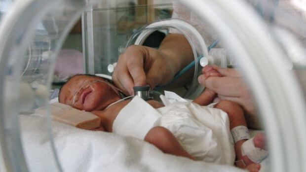 The union that represents the nurses said the shortages mean there aren't enough nurses to properly care for the babies.