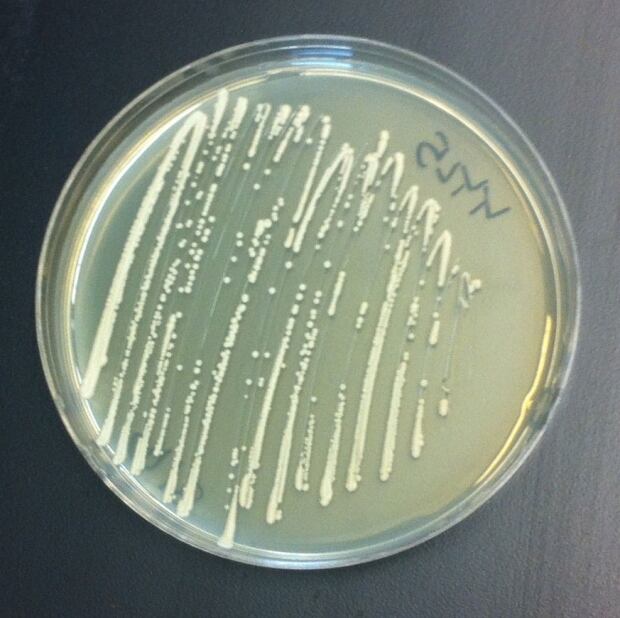 Yeast in petrie dish
