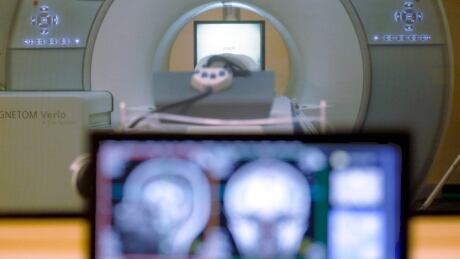 A brain-scanning MRI machine that was used at Carnegie Mellon University in Pittsburgh, for an experiment on tracking brain data is seen on campus. Men and women can look pretty different, but a new study says their brains can't be neatly divided into male and female. Specific parts of the brain show anatomical differences, but they only rarely line up to point to one sex or the other in a given person's brain, the researchers said. (AP Photo/Keith Srakocic, File) Brain Gender