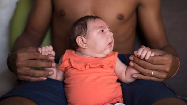 Brazilian health authorities are convinced that Luiza's microcephaly condition is related to the Zika virus that infected her mother during pregnancy. 