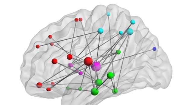 MEG imaging revealed unusual levels of connectivity between some brain regions in people with PTSD.