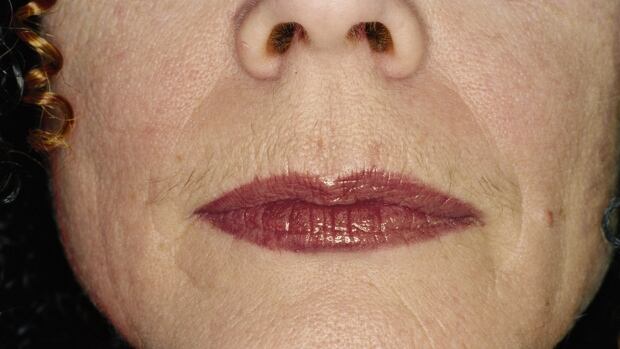Suzy Lake's Pluck #1(2001) 32 1/2" x 40". Colour gelatin print.