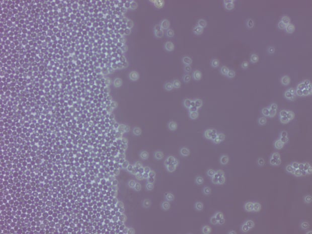 Cannabis yeast microscope