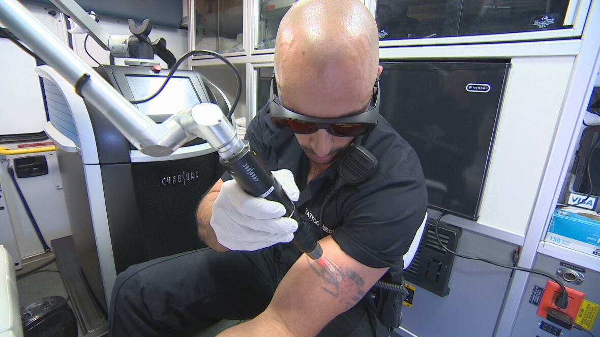 ambulance turned tattoo removal service wipes away worst ambulance turned tattoo removal service wipes away worst